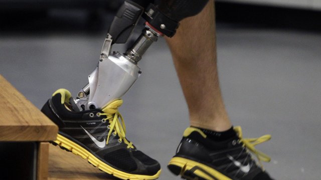Бионический протез ноги (видео)