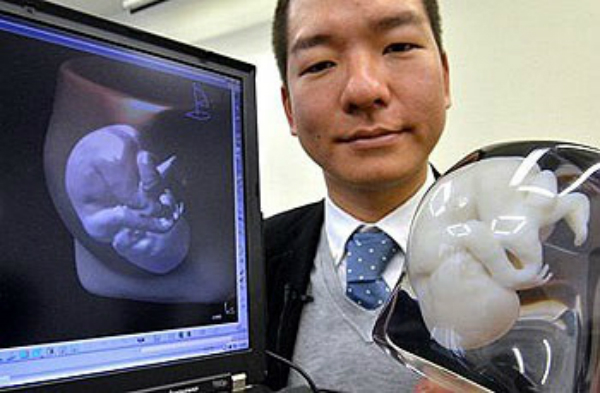 3D-модель плода - новая услуга для беременных японок