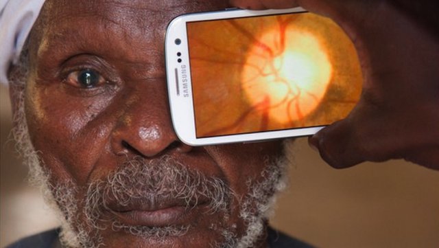 Проверить зрение можно при помощи смартфона (2 фото)