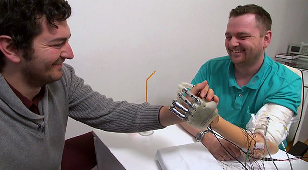 Высокочувствительный бионический протез (2 фото + видео)