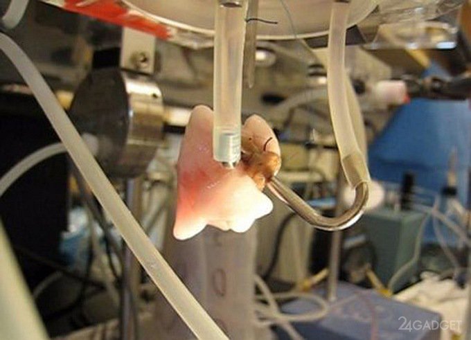 Выращивание органов — очередной шаг в развитии трансплантологии