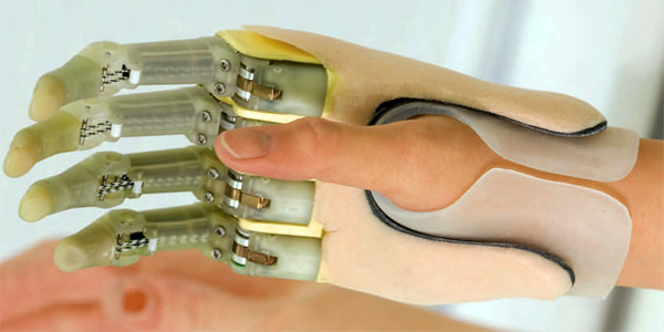 Бионические пальцы от Touch Bionics (2 видео)