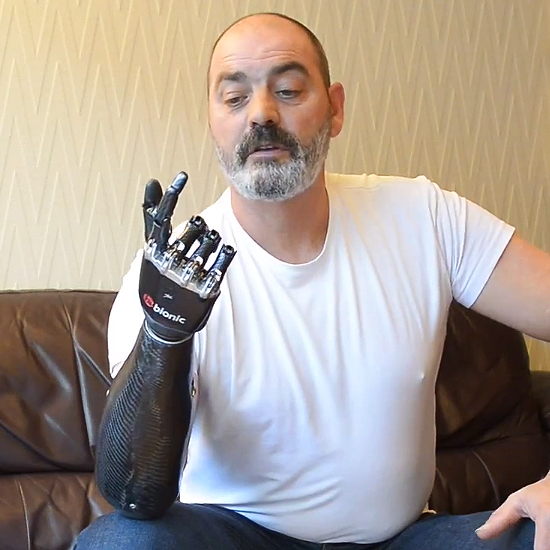 Bebionic3 - киберпротез руки (2 видео)