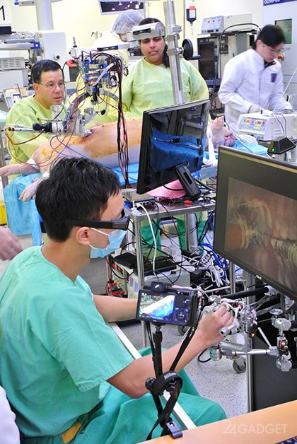 A robot surgeon is completely placed in the patient’s body (4 photos + video)