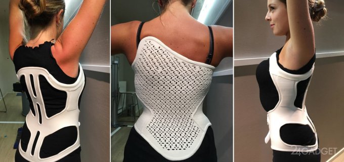 A physiotherapist from Italy creates orthopedic corsets on a 3D printer (7 photos + 2 videos)