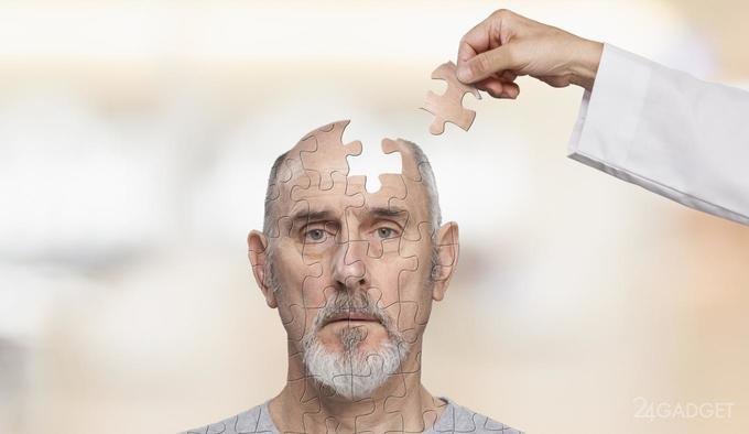 Alzheimer's disease can be predicted by a genetic test