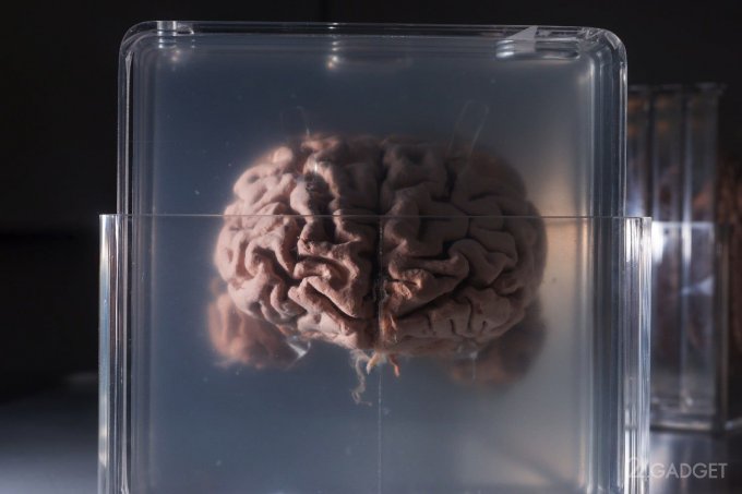 Nectome предлагает бессмертие через заморозку мозга и перенос сознания в облако (4 фото)