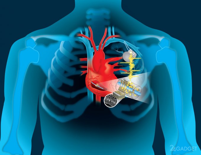 Энергией сердца начнут подзаряжать кардиостимуляторы (3 фото)
