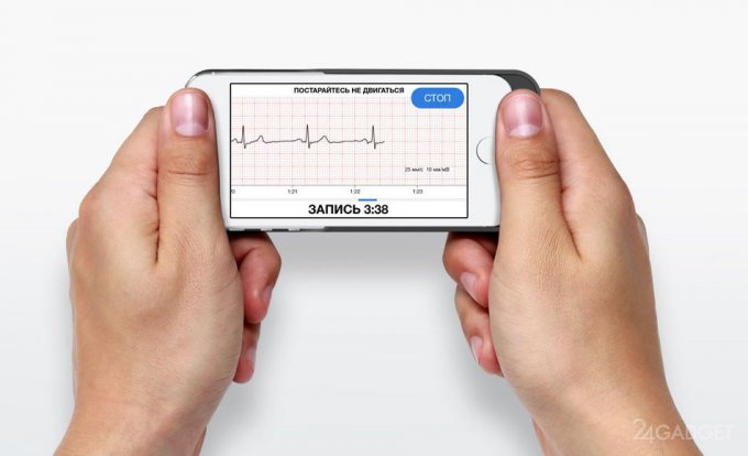 Российский кардиомонитор-чехол для смартфона придёт на помощь врачам и пациентам (5 фото)
