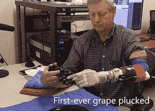 Биопротез, аналогичный руке Люка Скайуокера (4 фото + видео)