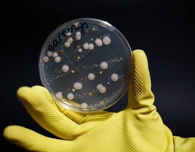 На украшениях обнаружили в 400 раз больше бактерий, чем на сидении унитаза (4 фото)
